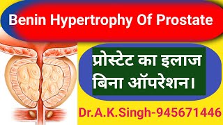 Prostate Problem प्रोस्टेट क्यों बढ़ता हैंपेशाब बूंद बूंद होना देर तक होना [upl. by Attirehs436]