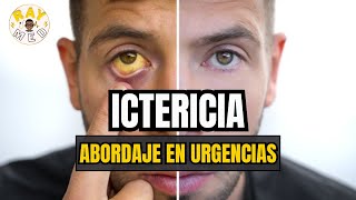 ICTERICIA  ABORDAJE CLÍNICO DE URGENCIAS🚨 [upl. by Molahs]