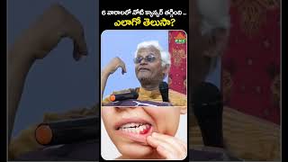 6 వారాలలో నోటి క్యాన్సర్ తగ్గింది  ఎలాగో తెలుసా  PMC Health [upl. by Adirahs]