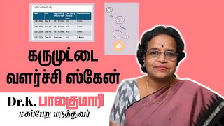 Follicular study  கரு முட்டை வளர்ச்சி ஸ்கேன் [upl. by Dixon184]