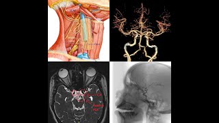 External carotid artery and its branches in detail [upl. by Tressia795]