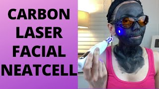 Carbon Laser Facial using Neatcell Picosecond Pen  At Home Carbon Facial  At Home Picosend Laser [upl. by Allen]