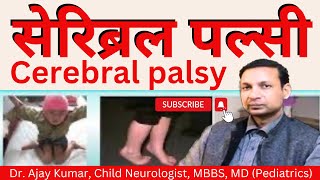 Cerebral Palsy  Dr Ajay Kumar Child Neurologist in Patna Call 7250023111 9546454005 [upl. by Avrom]