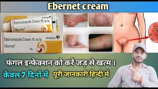 Ebernet cream use benefits and Side effects full review in hindi [upl. by Mortie]