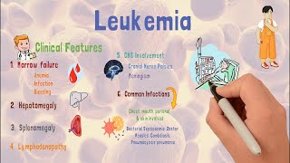 Leukemia  Causes  Types  Early signs amp Treatment [upl. by Yldarb841]