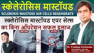 मल्टीपल स्क्लेरोसिस ट्रीटमेंट  sclerosis mastoid air cells ka ilaj  without surgery  homeopathy [upl. by Retrak]