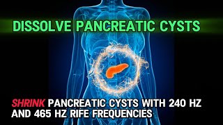 🎧 SHRINK Pancreatic Cysts with ➡️ 240 Hz and 465 Hz RIFE Frequencies [upl. by Ecyar]