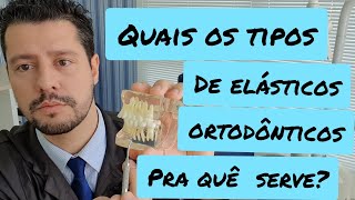 Quais os tipos de elástico ortodontico e pra quê servem [upl. by Tnilc]