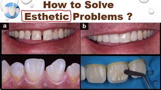 How to Solve Dental Esthetic Problems [upl. by Ormiston]