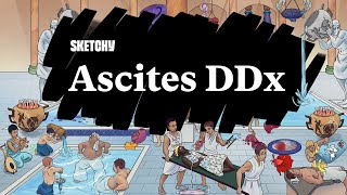 Ascites Diagnosis Causes amp DDx Guide Part 1  Sketchy Medical  USMLE Step 2 CK [upl. by Enelrahc251]