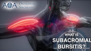 AOA Orthopedic Specialists  Subacromial Bursitis [upl. by Bertero835]