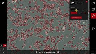 Confluency measurement with the Mateo TL microscope [upl. by Sarkaria5]