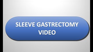 Laparoscopic Sleeve Gastrectomy  Weight Loss Surgery  Dr Sherif Awad [upl. by Cutcliffe531]