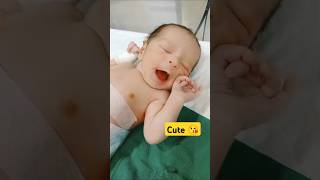 NICU CUTE BABY YAWNING FIRST TIME  CUTE BABY [upl. by Nolyd]