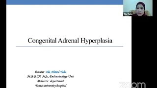 Congenital Adrenal Hyperplasia Dr Ola Taha EndocrinologyCourse [upl. by Atinauj]