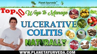 Top 10 Ways To Manage Ulcerative Colitis Naturally [upl. by Herve]