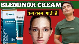 himalaya bleminor cream review  bleminor cream himalaya review  bleminor anti blemish cream [upl. by Shulem863]