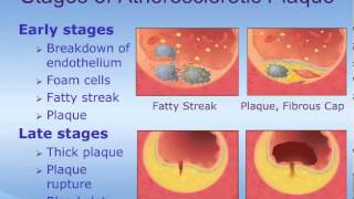 Acute Coronary Syndrome ACS  How it Happens [upl. by Atinahc]