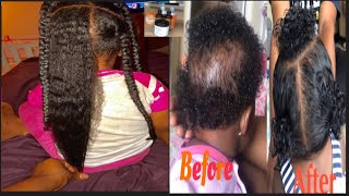 Babytoddler kids must have hair products for hair growth [upl. by Ahtenek]