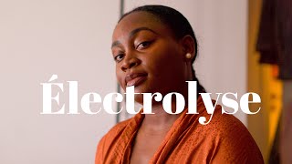 ELECTROLYSE  Epilation définitive  Deux ans après en suis je satisfaite [upl. by Netsrejk]