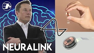 Neuralink ¿Qué es y cómo funciona este implante en tu cerebro 🧠 [upl. by Eneryt]