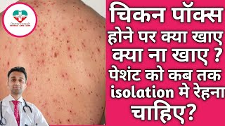 Chickenpox होने पर तुरंत करें इन चीजों से परहेज जल्‍द म‍िलेगा आराम [upl. by Culbert]