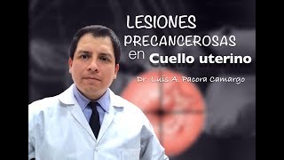 LESIONES EN CUELLO UTERINO POR QUE NO PAPANICOLAOU [upl. by Kristo]