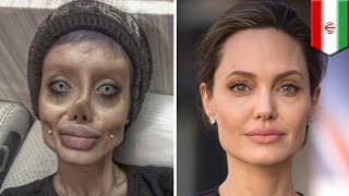 Extreme plastic surgery Angelina Jolie teen says shes gotten 50 operations  TomoNews [upl. by Anilat646]