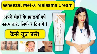 Wheezal MelX Cream Uses in Hindi  Wheezal MelX Cream Review  Mel X Cream  Mel X Melasma Cream [upl. by Izabel]