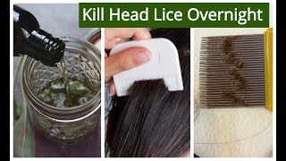 Homemade Hair OIL for Lice amp Nits Removal  KILL HEAD LICE amp NITS Overnight  Sushmitas Diaries [upl. by Benzel289]