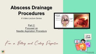 Episode 14 Abscess Drainage Lecture Series  Part 2 of 4 Needle Aspiration Procedure [upl. by Laurette89]