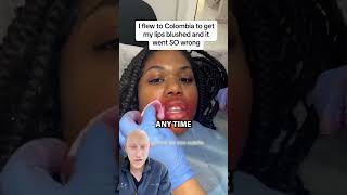 Lip Blushing GONE WRONG  Plastic Surgeon Reacts [upl. by Anilatak]