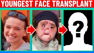 Plastic Surgeon Reacts to The Youngest Face Transplant Howd She Do [upl. by Ylrebmek]