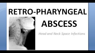 ENT Retropharyngeal Abscess Space Infection Node Rouviere Incision Drainage without anesthesia [upl. by Annaer]