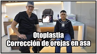 Otoplastia  Corrección de orejas en asa [upl. by Lakim]