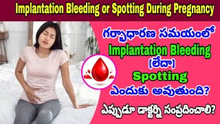 Implantation Bleeding amp Spotting అంటే ఏమిటి ఎలా గుర్తించాలి  Bleeding amp Spotting During Pregnancy [upl. by Ahsikyt598]