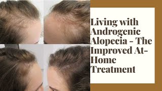 New Trends in Therapy for Androgenic Alopecia Part 2 [upl. by Subak224]