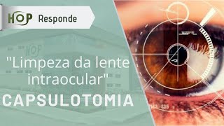 Capsulotomia quotlimpeza da lente intraocularquot [upl. by Paton955]