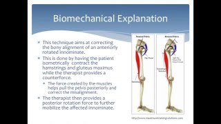 Mobilization to correct an Anterior Innominate rotation of the pelvis Physical Therapy [upl. by Yesima]