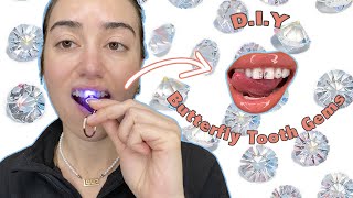 How to get your tooth jewelry  tooth gem done  get a sparkling smile  FMS DENTAL HOSPITALS [upl. by Yecnahc735]