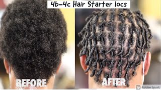 💋Learn how to  Starter Locs on 4b4c Hair [upl. by Eremaj]