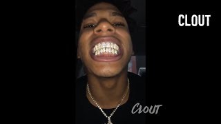 NLE Choppa Shows Off His New Diamond quotGrillzquot Bust Down quotAudemars Piguetquot amp VVS Diamond Pendants [upl. by Arocal]