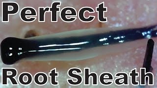 Hair Root CloseUp Part22 完全無欠な透明毛根鞘を超接写【Perfect RootSheath】 [upl. by Nylessej]