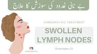 Swollen Lymph Nodes in Neck Homeopathic Treatment  SCROFULA ENLARGED GLANDS  Bioplasgen 22 [upl. by Ermentrude]