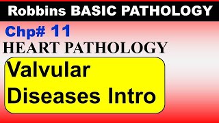 Chp11 Robbins Patho  Heart Pathology  Introduction to Valvular Heart Disease  Dr Asif Lectures [upl. by Coleville]