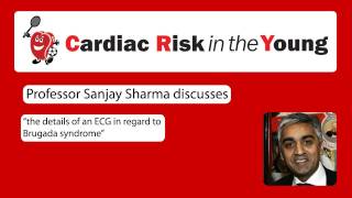 ECG 11 Brugada syndrome [upl. by Nedap]