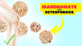 Ibandronate Sodium Supporting Bone Health and Osteoporosis Prevention [upl. by Cassilda]