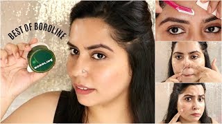 Top 5 Surprising Uses of BOROLINE🤔  Remove Pimple amp Acne in 3 Days  Beauty Hacks [upl. by Phil]