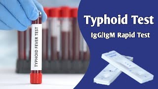 Typhoid Rapid Test  কিভাবে টাইফয়েড পরীক্ষা করা হয়  IgGIgM rapid test [upl. by Mckenna906]