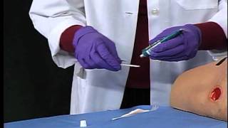 3M™ Tegaderm™ Hydrogel Wound Filler  Application and Removal [upl. by Lezti501]